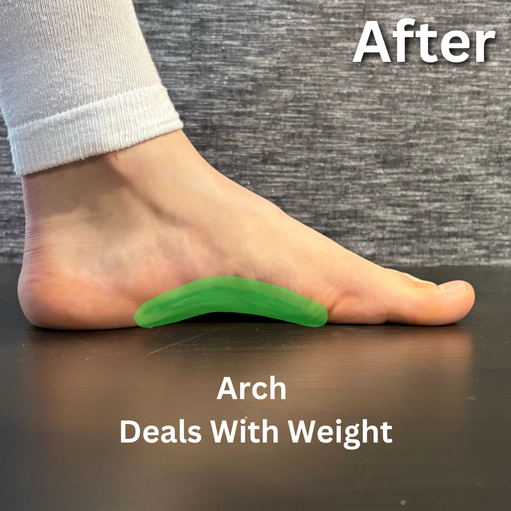 VIREON™ ARCRA™ Foot Trainer: Doctor-Approved Technology for Arch Support