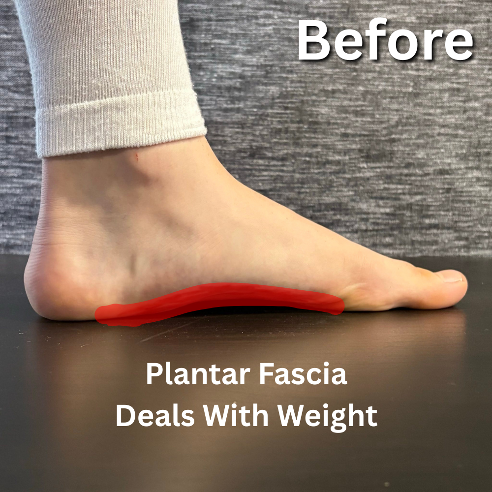 VIREON™ ARCRA™ Foot Trainer: Doctor-Approved Technology for Arch Support